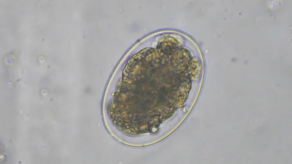 Makro hookworm jaj pasożyta w badaniu stolca. — Zdjęcie stockowe