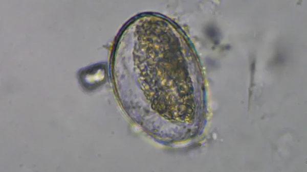 대변 검사에서 매크로 Gnathostoma spinigerum 계란. — 스톡 사진