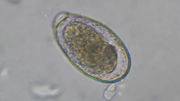 대변 검사에서 매크로 Gnathostoma spinigerum 계란. — 스톡 사진