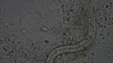 Strongyloides stercoralis larva dışkı muayenesinde. İnsanda parazit.