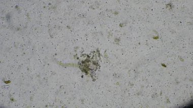 Strongyloides stercoralis larva dışkı muayenesinde. İnsanda parazit.