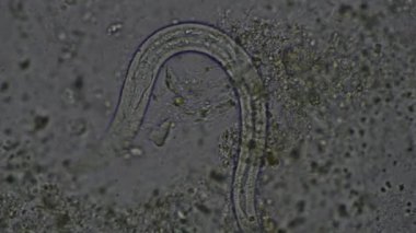 Strongyloides stercoralis larva dışkı muayenesinde. İnsanda parazit.