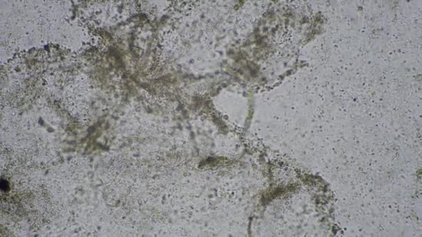 Strongyloides Stercoralis Larva Stool Exam Parasite Human — Stock Video