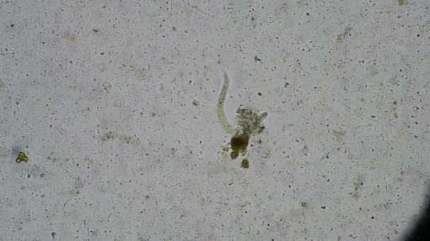 Strongyloides Stercoralis Larva Dışkı Muayenesinde Nsanda Parazit — Stok video