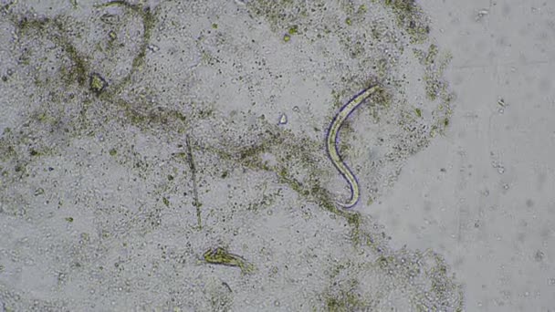 スツール検査でステロイドステロリス幼虫 ヒトの寄生虫 — ストック動画