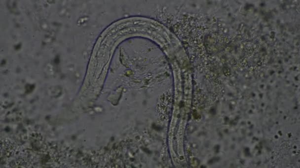 Strongyloides Stercoralis Larve Dans Les Selles Exam Parasite Chez Homme — Video