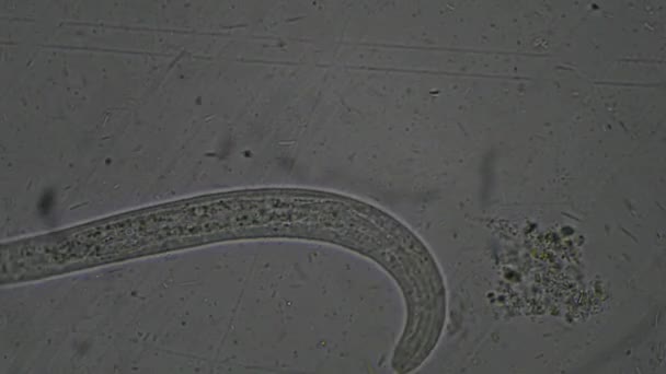 Larva Strongyloides Stercoralis Examen Heces Parásito Humanos — Vídeos de Stock