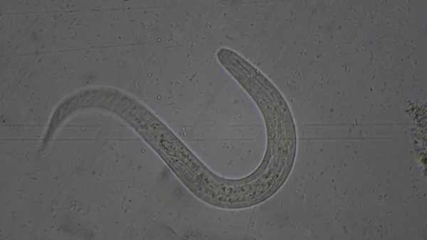 Larva de Strongyloides stercoralis no exame de fezes . — Fotografia de Stock