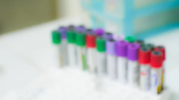 Blurred color of test tube in laboratory.