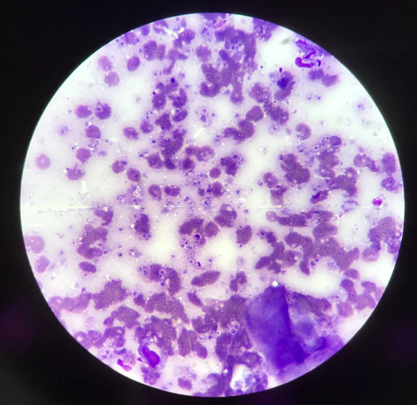 涂片实验室科学背景概念中酵母细胞二元分裂细胞的萌发 — 图库照片