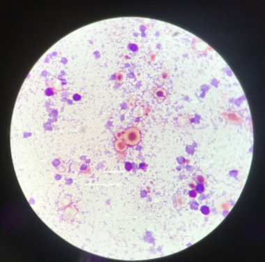 Laboratuvarda mikroskop ile gelişen maya hücre yapısı bulgusu.