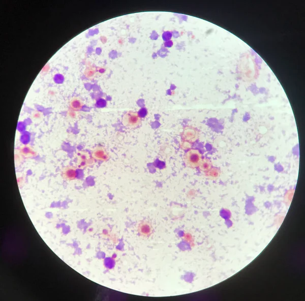 Поиск Структуры Дрожжевых Клеток Помощью Микроскопа Лаборатории — стоковое фото