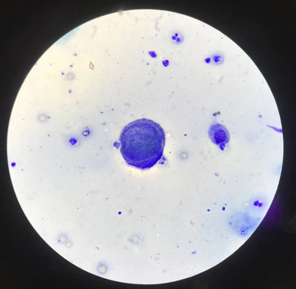 Багатоядерні Клітини Цанку Тестові Відкриття Мікроскопом Лабораторних Умовах — стокове фото