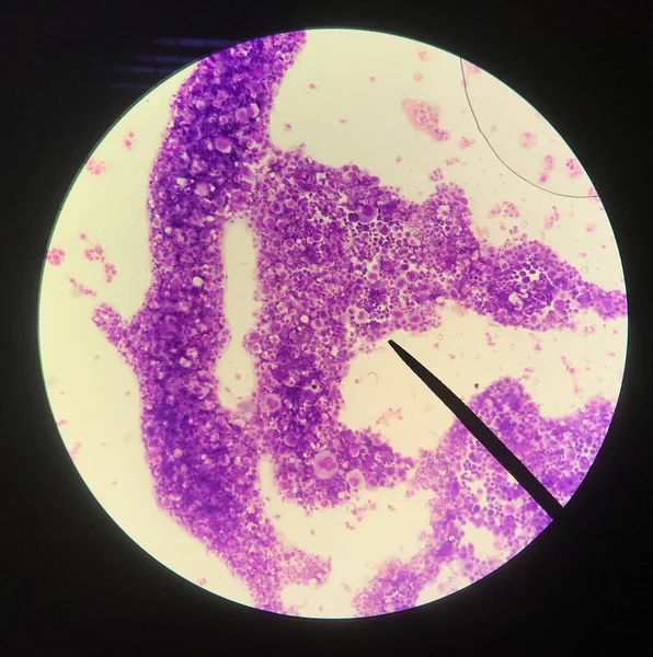 Concepto Anormal Ciencia Frotis Sangre Células Sanguíneas —  Fotos de Stock