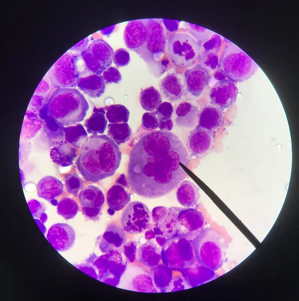 Abnormal blood cell blood smear science concept.