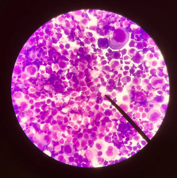 Abnormal blood cell blood smear science concept.