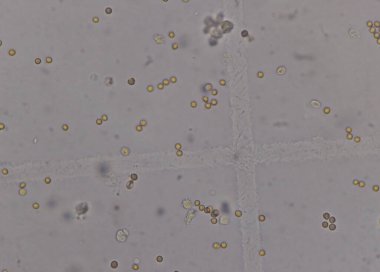 İdrar tahlili için idrar Test Laboratuvarı Ekipmanı Sarı Kapak Tüpleri Boş doldurulmuş donmuş ve dipstick simgesi izole edilmiş elementleri ayarla.