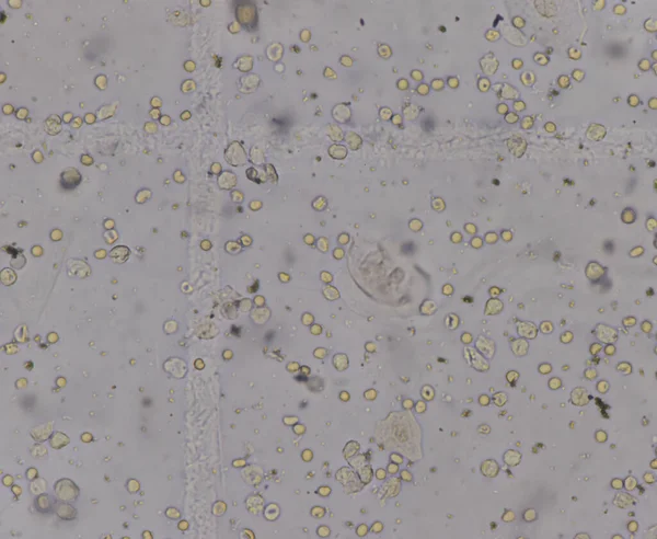 Rbc Wbc Idrar Bakterileri Mikroskopla Bulundu — Stok fotoğraf