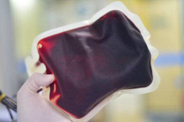 Kan torbası laboratuvarını kapatın..