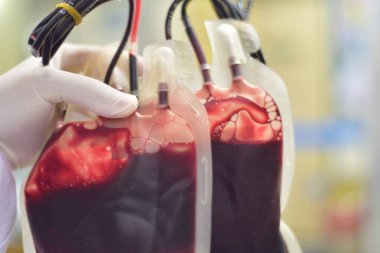 Kan torbası laboratuvarını kapatın..