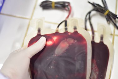 Kan torbası laboratuvarını kapatın..