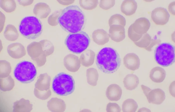 Kırmızı Kan Hücrelerinin Tıbbi Arka Planında Olgun Lenfosit — Stok fotoğraf