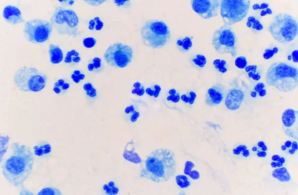 Μπλε Λευκά Αιμοσφαίρια Στο Σώμα Υγρό Δείγμα Ιατρικό Υπόβαθρο — Φωτογραφία Αρχείου