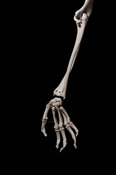 ヒト前腕骨格解剖学的骨 — ストック写真