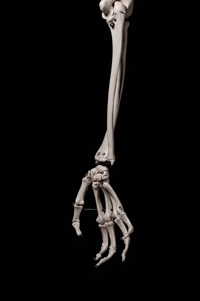 Menselijk Onderarm Skelet Anatomie Bot Rechtenvrije Stockfoto's