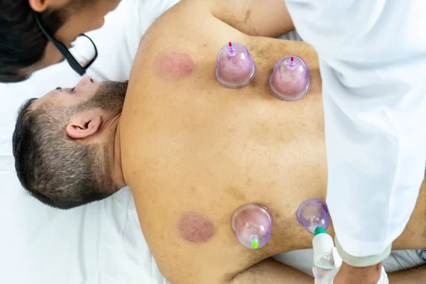 Arabic Muslim Therapist Treating Patient Cupping Therapy — Stock Photo, Image