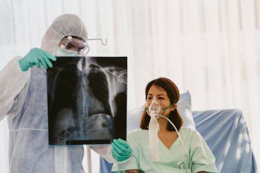 Covid-19 gribi olan hastalara bakan radyolog, solunum hastalığına sahip bir kadının göğüs röntgenine baktı ve hastanedeki hastaya durumu açıkladı..