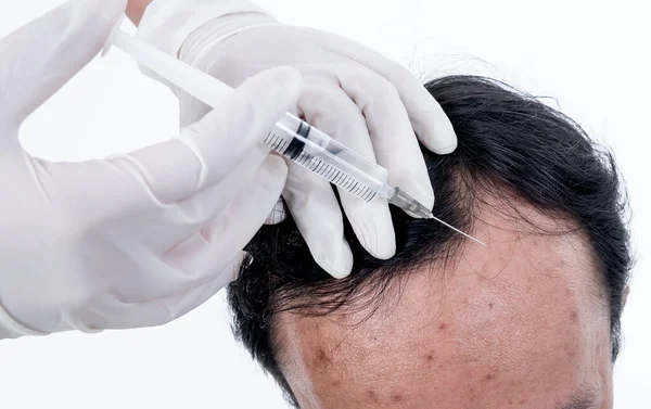 stock image Top view images of a man receiving treatment With injections serum on skin around the head, In which he has problems with hair loss And the face is acne On white background to glabrous concept.