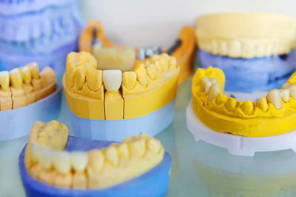 Produkcja Implantów Dentystycznych — Zdjęcie stockowe