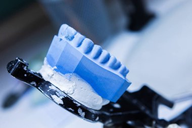 Diş protezi laboratuarı. Yakın plan.