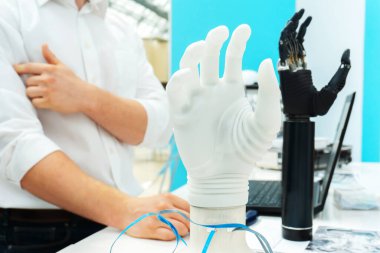 Biyonik el. Uzuv protezlerinin modern teknolojisinin gösterimi.