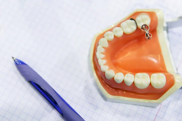 Artificial human jaw prosthesis in a dental laboratory