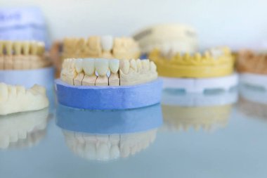 Diş implantı yapıyorum. Diş Laboratuvarı