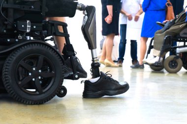 A man with a prosthetic leg in an electric wheelchair on the background of the medical staff. Rehabilitation of people with disabilities. Cropped frame. No face. clipart