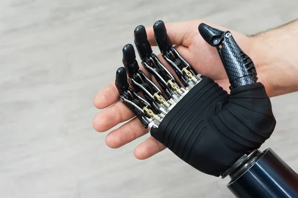 Bionic Hand Prosthetic Human Limbs Manufacturing Artificial Limbs Carbon — Stock Photo, Image