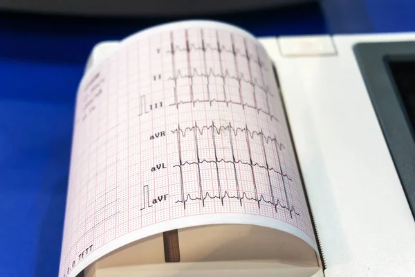 Electrocardiógrafo Portátil Medicina Móvil Situaciones Emergencia Primer Plano — Foto de Stock
