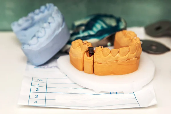 The manufacture of dental implants. The layout of the jaw with teeth lies on the table in the dental laboratory.