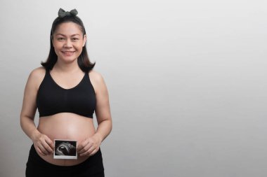 Asyalı hamile kadın kameraya bakıp gülümsüyor ve elinde bebeğinin ultrason fotoğrafı, stüdyo ışık portresi ve gri arka planda fotokopi alanı var.