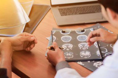 Bulanık görüntü, doktor, tümör ameliyatı ya da hastanın beynindeki kanserle ilgili bir plan yapmak için hastanın beyninin röntgen filminde tümör resmi ya da kanseri teşhis ediyor.