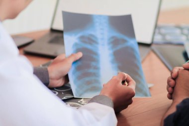 Bulanık resim, tıbbi ekip Coronavirus covid-19 akciğer röntgeni filmini araştırıyor hastayı bilgilendirmek ve semptomları Coronavirus covid-19 'un gösterdiği gibi tedavi etmek için..