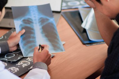 Bulanık resim, tıbbi ekip Coronavirus covid-19 akciğer röntgeni filmini araştırıyor hastayı bilgilendirmek ve semptomları Coronavirus covid-19 'un gösterdiği gibi tedavi etmek için..