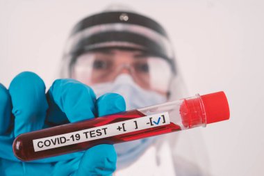 Corona virüsü kan testi konsepti: Koruyucu maskeli, mavi eldivenli ve gözlüklü bir laboratuvar çalışanı NeGATIVE COVID-19 sonuçlu bir kan testi tüpü tutuyor.
