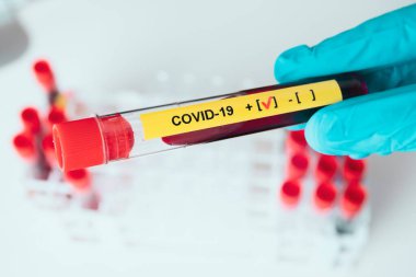 Corona virüsü kan testi konsepti: Mavi eldivenli bir el POSITIVE COVID-19 içeren bir test tüpü tutuyor
