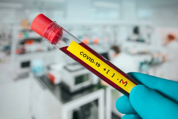 Corona virüsü kan testi konsepti: Mavi eldivenli bir el negatif COVID-19 içeren bir test tüpü tutuyor. Arka plandaki laboratuvar