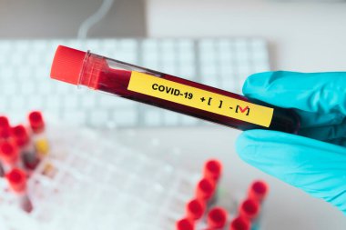 Corona virüs kan testi konsepti: Mavi eldivenli bir el negatif COVID-19 içeren bir test tüpü tutuyor.
