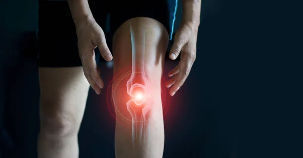 Ältere Frau, die unter Schmerzen im Knie leidet. Sehnenprobleme und Gelenkentzündung auf dunklem Hintergrund. — Stockfoto